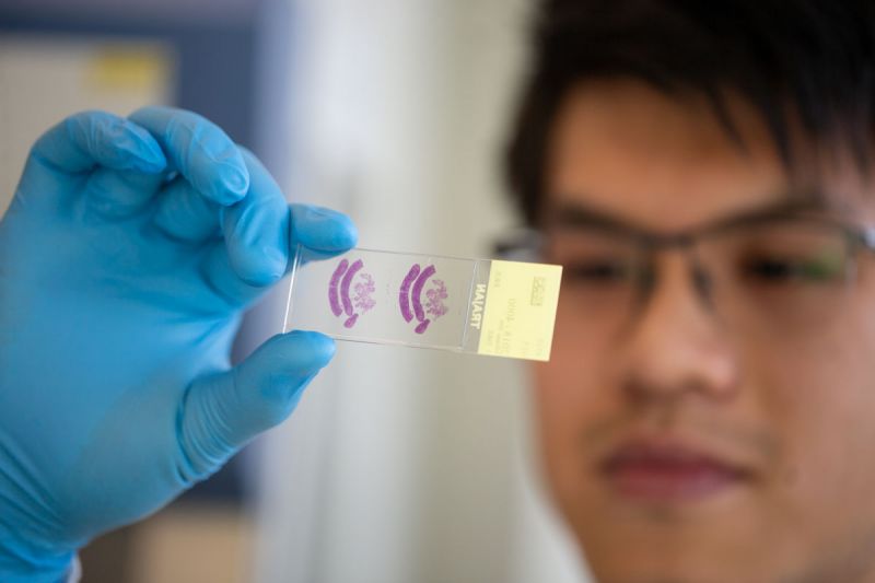 Purple pathology slide being held up in lab